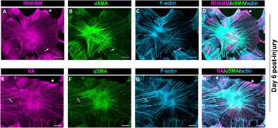 The Pro-fibrotic Response of Mesenchymal Leader Cells to Lens Wounding Involves Hyaluronic Acid, Its Receptor RHAMM, and Vimentin